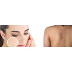 Soluciones para la piel atópica con productos naturales, Gamarde